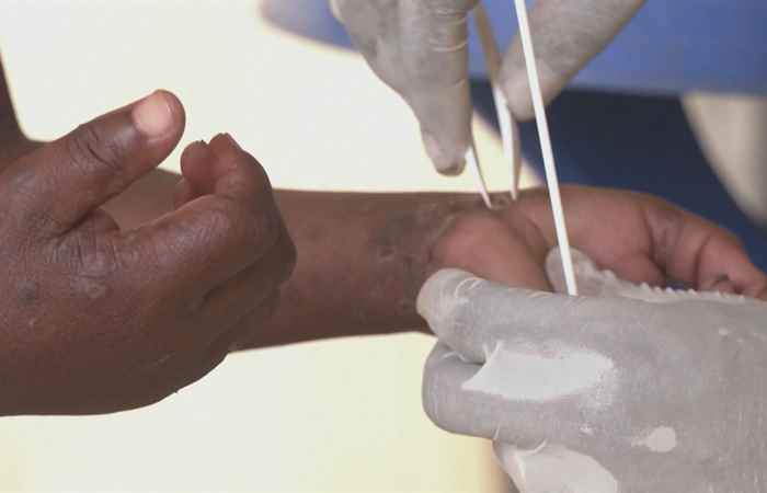 Bản tin  STV NEWS (17-08-2024)