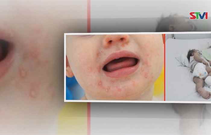 Nhịp cầu sức khỏe 16-06-2018