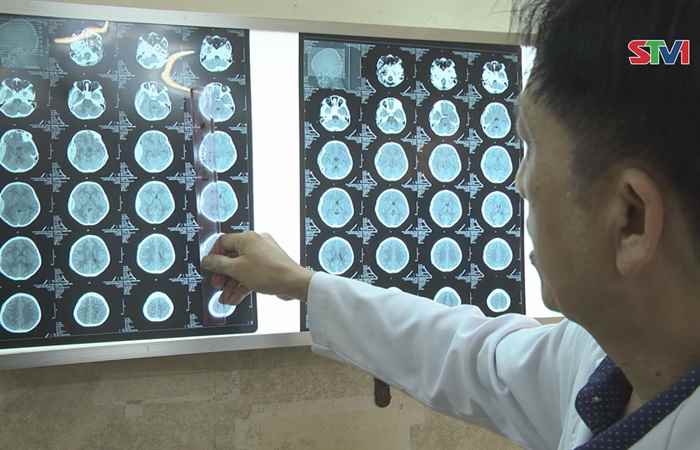Bệnh viện Chuyên khoa Sản- Nhi Sóc Trăng cấp cứu thành công bệnh nhi bị chấn thương sọ não
