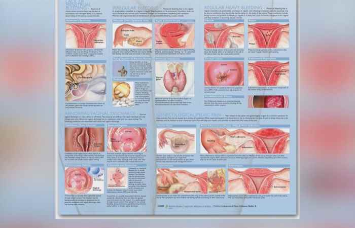 Sống khỏe 360 - Bệnh phụ khoa do đâu mà mắc (06-11-2019)