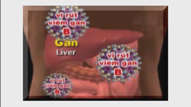 Nhịp cầu y tế- Điều trị viêm gan B 01-07-2016